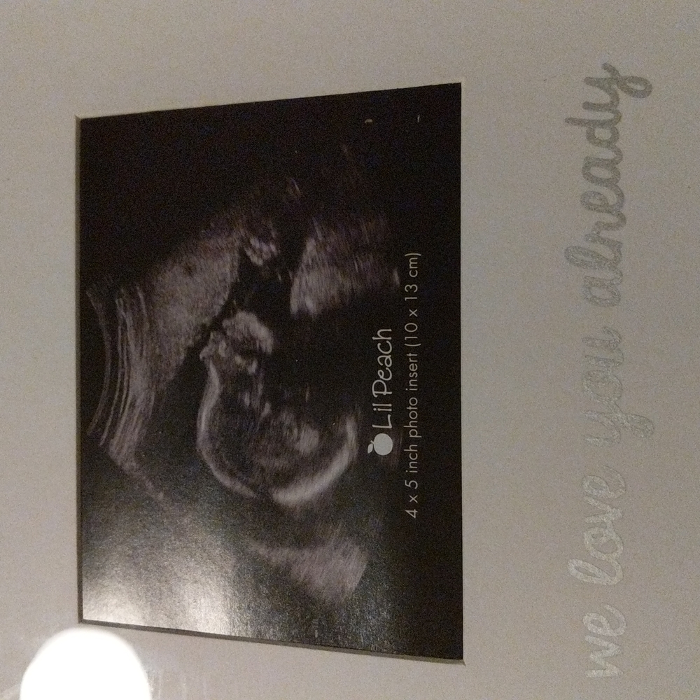 SONOGRAM 4" X 5" insert we picture frame "we love you already" frame 9 X 9" 🆕 - Picture 2 of 3